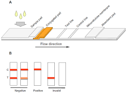 Lateral flow rapid tests provide results quickly. Full Text Lateral Flow Test Strip Based On Colloidal Selenium Immunoassay For Ra Ijn