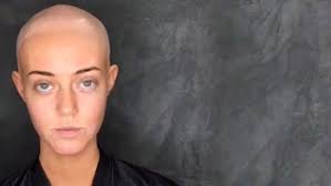 El conmovedor video de la modelo que padece alopecia