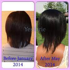 Before And After The Breakage On One Side Of My Hair Is Real I Have To Find The Source What Is Causing My Extreme Natural Hair Ideas Hair Hacks Great Hair