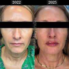 ✨ Aging Backwards ✨ This beautiful soul has trusted me with her skin for  over 3 years, and the results speak for themselves—radiant, youthful, and  glowing ✨ Here's what consistent maintenance looks