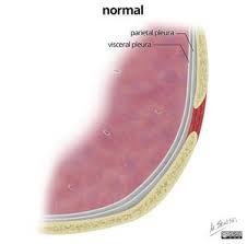 We did not find results for: Mesothelioma Physiopedia