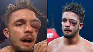 Adanalı Anthony Yiğit Unvan Maçında Yürekleri Ağza Getirdi