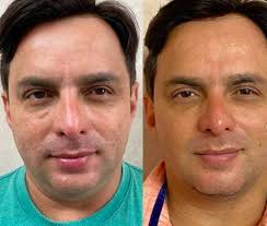 Noivo De Gretchen Nao Esta So Homens Estao Mais Vaidosos Lifestyle R7 Beleza