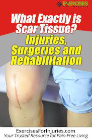 Pin On Ankle Fracture And Recovery