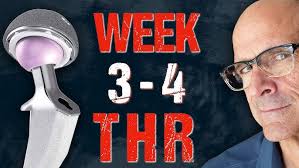 Hip Replacement explained by Dr. J. Stuart Melvin, Orthopedic Surgeon