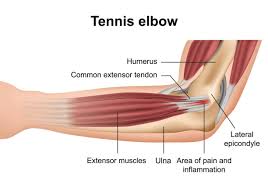 Nourishes flexor tendons located outside of synovial sheaths. 6 Effective Ways To Treat Elbow Tendon And Tendonitis