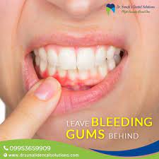 Pin On Dr Sunali S Dental Solutions