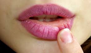 Es Malo Arrancarse Los Cueritos De Los Labios Kienyke