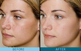 Pin On Change Your Skin