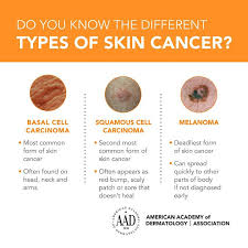 Abnormal cells grow and can form tumors. The University Of Kansas Health System Skin Cancer Is A Lifestyle Disease Affecting The Young Old And Everyone In Between One In Five Americans Will Develop Skin Cancer In His Or