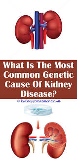 Kidney Disease Symptoms Dialysis Kidney Disease Recipes Polycystic Kidney Disease Kidney Disease