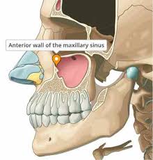 Image result for Maxillary Sinus