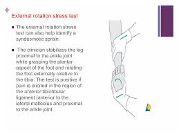 Image result for Ankle External Rotation Test