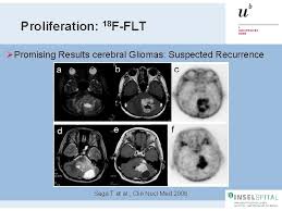 Maybe you would like to learn more about one of these? Petct In Oncology Pet Tracers Other Than Fdg