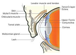 Now supporting google or microsoft login. Inverted Eyelashes Epiblepharon Treatment Eye Doctor Specialist Nyc