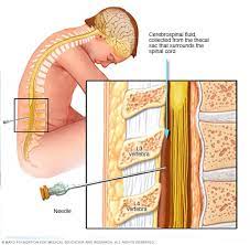 Symptoms of multiple sclerosis may not be apparent to others for years. Ø§Ù„ØªØµÙ„Ø¨ Ø§Ù„Ù…ØªØ¹Ø¯Ø¯ Ø§Ù„ØªØ´Ø®ÙŠØµ ÙˆØ§Ù„Ø¹Ù„Ø§Ø¬ Mayo Clinic Ù…Ø§ÙŠÙˆ ÙƒÙ„ÙŠÙ†Ùƒ