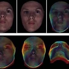 A: Dysmorphometric analysis of an individual with...