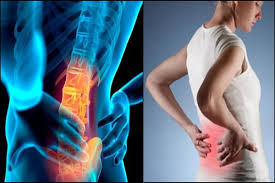 The lower part of the back, just above the waist. Causes Remedies For Back Pain After C Section Ujala Cygnus