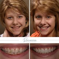 Rochester Advanced Dentistry