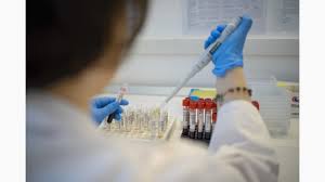 Proteina c reactivă (pcr) este un reactant de fază acută (marker specific inflamației) ale cărui valori cresc extrem de mult în plasmă (aproximativ de 100 de ori față de valoarea inițială) în cazul traumatismelor severe, proceselor inflamatorii, infecțiilor bacteriene, afecțiunior tumorale sau. Anti Hcv Cantitativ Elfa ProvidenÈa PoliclinicÄ Èi Spital