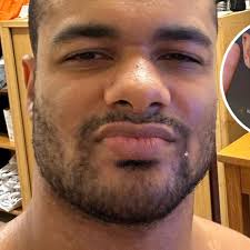 Brian Keller hat TikToker Skorp808 niedergeschlagen