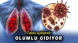 Peki bugün 7 haziran pazartesi 2021 günü dünyadaki koronavirüs son durumu nedir, kaç ölü var, kaç vaka var, iyileşen sayısı kaç? 7 Haziran Koronavirus Tablosu Aciklandi Kovid Oncu Sehir Gazetesi
