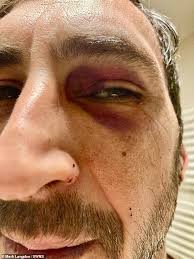 British businessman, 46, describes kidnap hell after being beaten  unconscious by masked men who raided his apartment during Brussels work  trip: 'I begged them not to stab me'