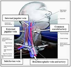 Visualize the anatomy of the neck and think of the skin, thyroid Ct Evaluation Of Anatomical Variations Of The Internal Jugular Veins In Thai Adults Semantic Scholar