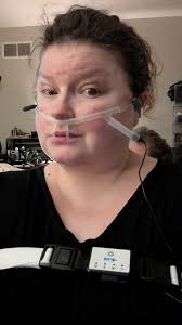 Did I do the at-home sleep apnea test correctly?