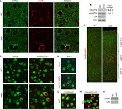 Chemal and gegg gina set 004. Loss Of Mitochondrial Function Impairs Lysosomes Journal Of Biological Chemistry
