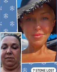 ❤️❤️ IVE DARED TO DO A FACE TO FACE FRIDAY ❤️❤️  —————————————————————————————— Hi folks 🙂 it's taken me a lot to do this  post, but I get so many folk asking