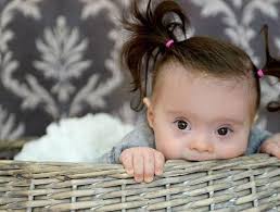 down inci si ve guclu annesinin basari hikayesi