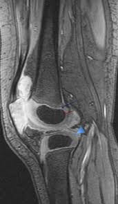 Thigh muscles also protect neurovascular structures as they go through the proximal hip joint to the knee and lower leg (3). Epos C 3356