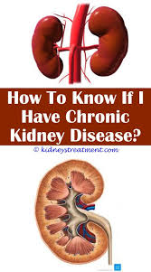 Eye Opening Cool Tips 14 Polycystic Kidney Disease Autosomal Dominant Definition Cheese And K Kidney Disease Polycystic Kidney Disease Kidney Disease Symptoms