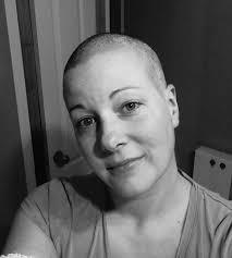 The condition occurs at a median. My Inflammatory Breast Cancer Story Our Voices Blog Cbcn
