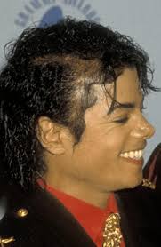 This was Michael's final public appearance with his real hair out, besides  a hairpiece