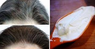 Beyazlayan Saclara Yogurt Kuru Beyaz Sac Sac Dogal Siyah Sac