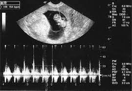 Free ultrasound clinic near me. Unplanned Pregnancy Why You Need An Ultrasound Pregnancy Test Center Birmingham Al