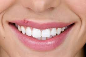 Le temps de réception d'une amende vos points ne vous seront retirés qu'après paiement de la contravention, ou au moment de la majoration. Bouton De Fievre Comment Soigner L Herpes Buccal Ou Herpes Labial Doctissimo