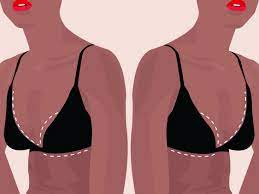 Maybe you would like to learn more about one of these? Breast Reduction Surgery Guide What To Expect From Cost To Recovery Time Allure