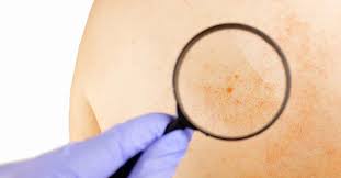 Information and translations of medical sign in the most comprehensive dictionary definitions resource on the web. Signs And Symptoms Definition Importance And Uses