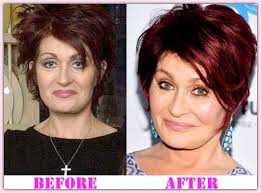 Sharon Osborne Plastic Surgery A Diagnosis Of Its Effect Plastic Surgery Under The Knife Cosmetic Surgery