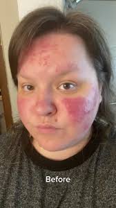 Mary Kay CC Cream Review: Redness-Lessening Makeup for Rosacea