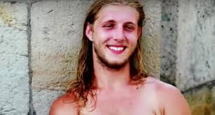 Patrick Hardison got a new face after third-degree burns, this is him today