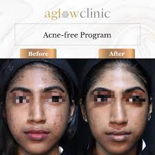 Aglow Clinic