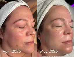 The Beauty Room Medi Spa