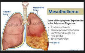 Pin On Health