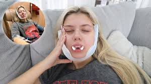 Mariah's got her wisdom teeth pulled🤣*Hilarious*