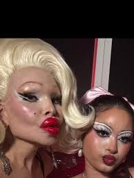 Lips Look Like Amanda Lepore