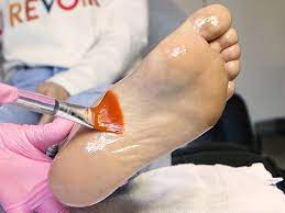 Dryness is the primary cause of peeling skin on the feet, so it's critical that you keep your skin. Chemical Foot Peel Removes Crusty Dead Skin And Callus Buildup